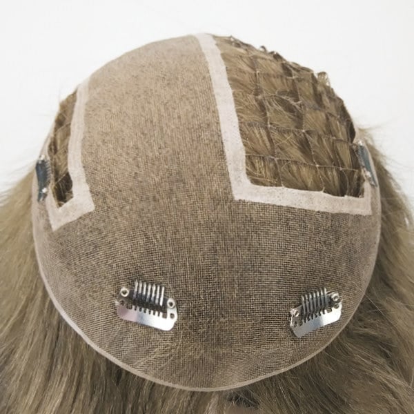 Gallery Thumb מערכת שילוב רשת עם טופ מונו מערכת שילוב רשת עם טופ מונו                                                   2