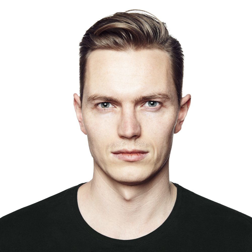 מערכת שיער פרונטלית