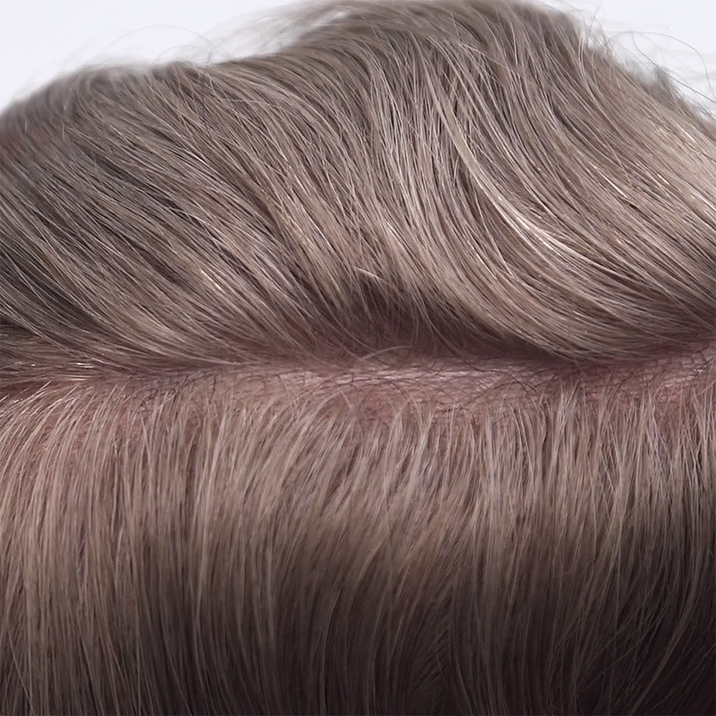 מערכת לולאת וי לשיער 0.06 מ"מ מערכת לולאת וי לשיער 0.06 מ"מ                                      1 1000x1000